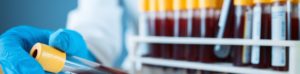 Lab Services Blood Work