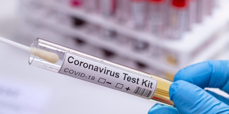 Coronavirus Covid 19 Test Kit Novel Corona Virus